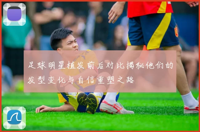 足球明星植发前后对比揭秘他们的发型变化与自信重塑之路